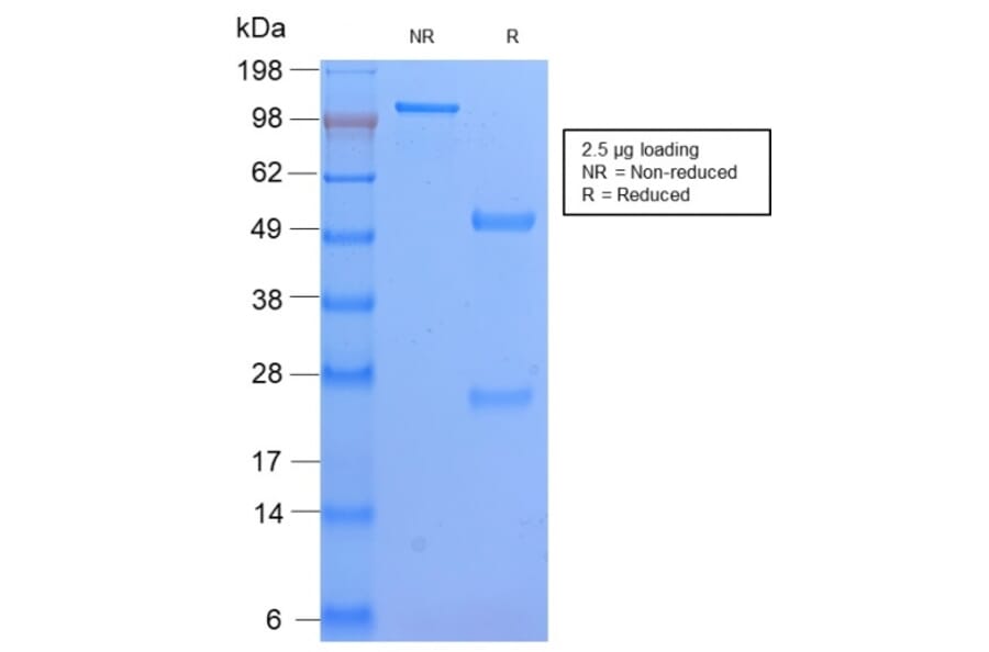 SDS-PAGE - Anti-HLA DP Antibody [HLA-DPB1/2862R] - BSA and Azide free (A252022) - Antibodies.com