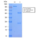 SDS-PAGE - Anti-HLA DP Antibody [HLA-DPB1/2862R] - BSA and Azide free (A252022) - Antibodies.com