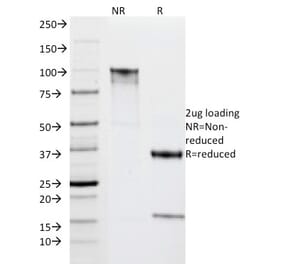 SDS-PAGE - Anti-HLA DRA Antibody [IPO-10] - BSA and Azide free (A252026) - Antibodies.com