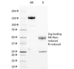 SDS-PAGE - Anti-HLA DRA Antibody [169-1B5.2] - BSA and Azide free (A252028) - Antibodies.com