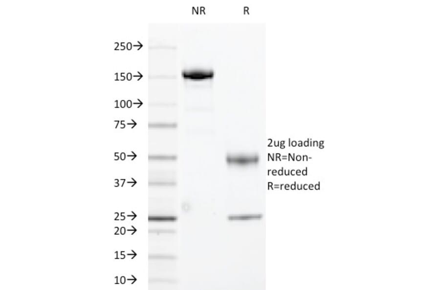 SDS-PAGE - Anti-HLA DRA Antibody [169-1B5.2] - BSA and Azide free (A252028) - Antibodies.com