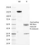 SDS-PAGE - Anti-HLA DRA Antibody [169-1B5.2] - BSA and Azide free (A252028) - Antibodies.com