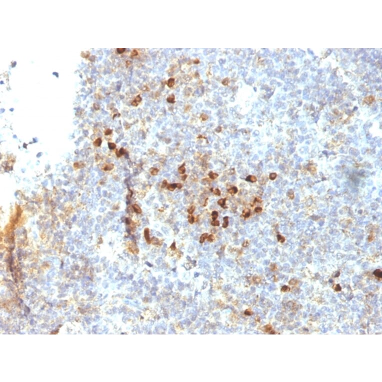 Immunohistochemistry - Anti-HLA DRA Antibody [19-26.1] - BSA and Azide free (A252029) - Antibodies.com