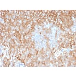 Immunohistochemistry - Anti-HLA DR Antibody [TAL 1B5] - BSA and Azide free (A252030) - Antibodies.com