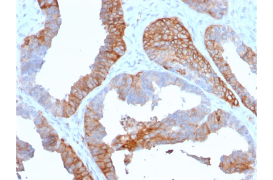 Immunohistochemistry - Anti-HLA DR Antibody [TAL 1B5] - BSA and Azide free (A252030) - Antibodies.com
