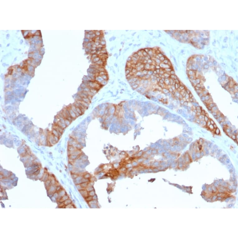 Immunohistochemistry - Anti-HLA DR Antibody [TAL 1B5] - BSA and Azide free (A252030) - Antibodies.com