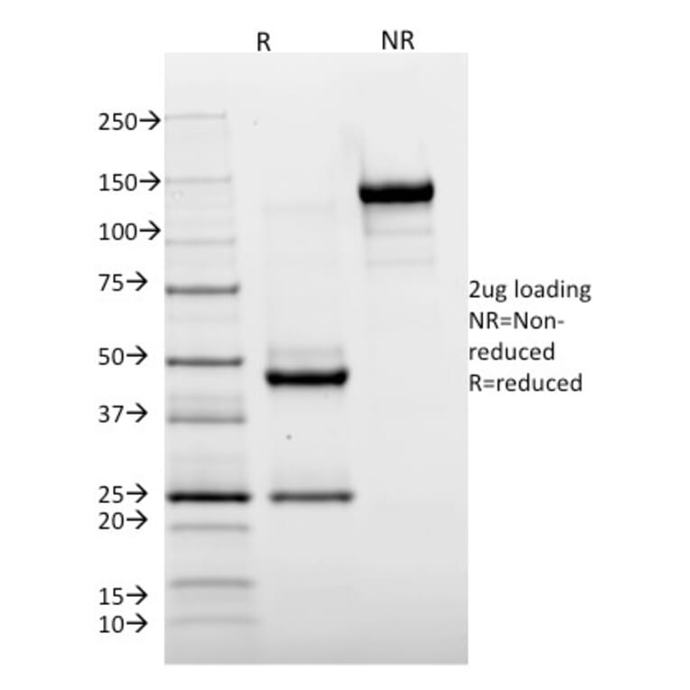 SDS-PAGE - Anti-HLA DR Antibody [TAL 1B5] - BSA and Azide free (A252030) - Antibodies.com