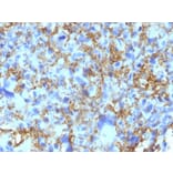 Immunohistochemistry - Anti-HLA DRB Antibody [LN-3] - BSA and Azide free (A252031) - Antibodies.com
