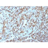 Immunohistochemistry - Anti-HLA DRB Antibody [LN-3] - BSA and Azide free (A252031) - Antibodies.com