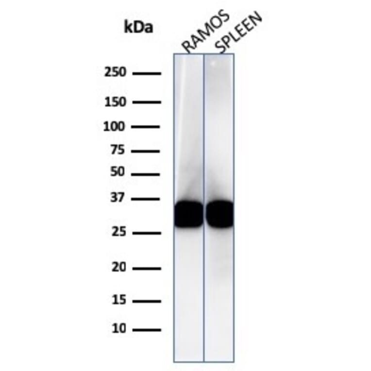 Western Blot - Anti-HLA DRB Antibody [LN-3] - BSA and Azide free (A252031) - Antibodies.com