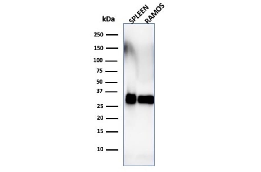 Western Blot - Anti-HLA DRB Antibody [SPM288] - BSA and Azide free (A252033) - Antibodies.com