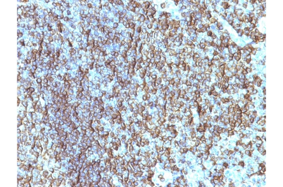 Immunohistochemistry - Anti-HLA DRB Antibody [SPM288] - BSA and Azide free (A252033) - Antibodies.com