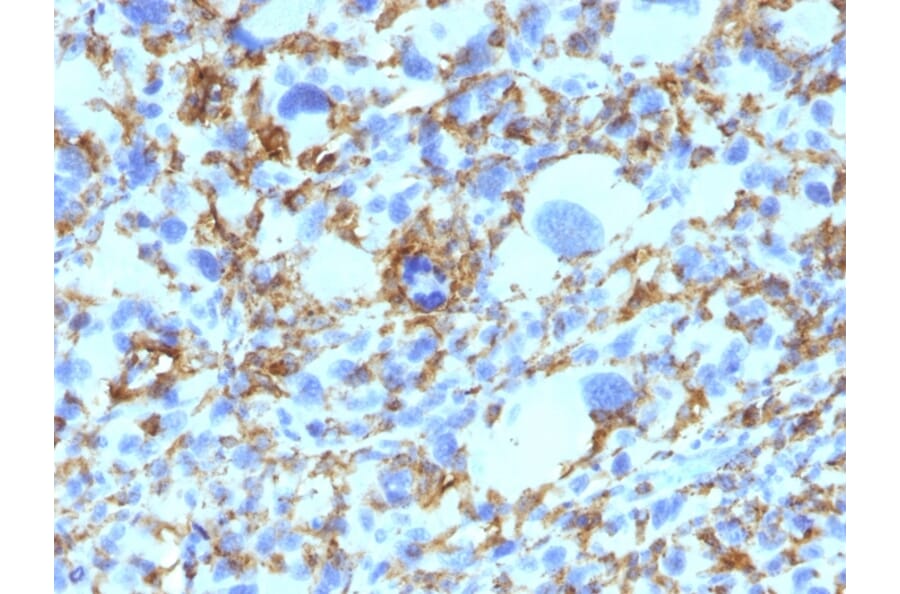 Immunohistochemistry - Anti-HLA DRB Antibody [SPM423] - BSA and Azide free (A248854) - Antibodies.com