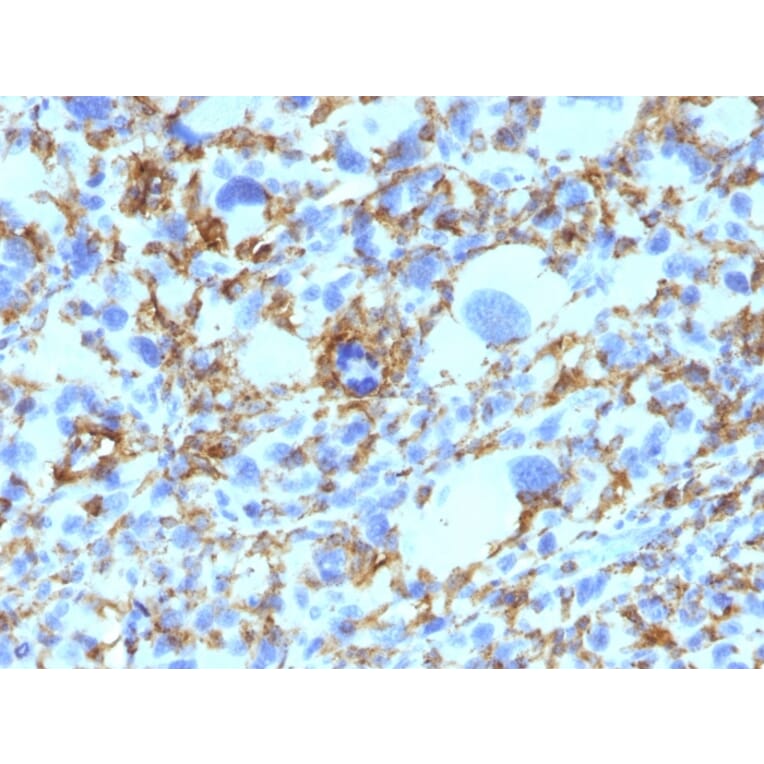 Immunohistochemistry - Anti-HLA DRB Antibody [SPM423] - BSA and Azide free (A248854) - Antibodies.com