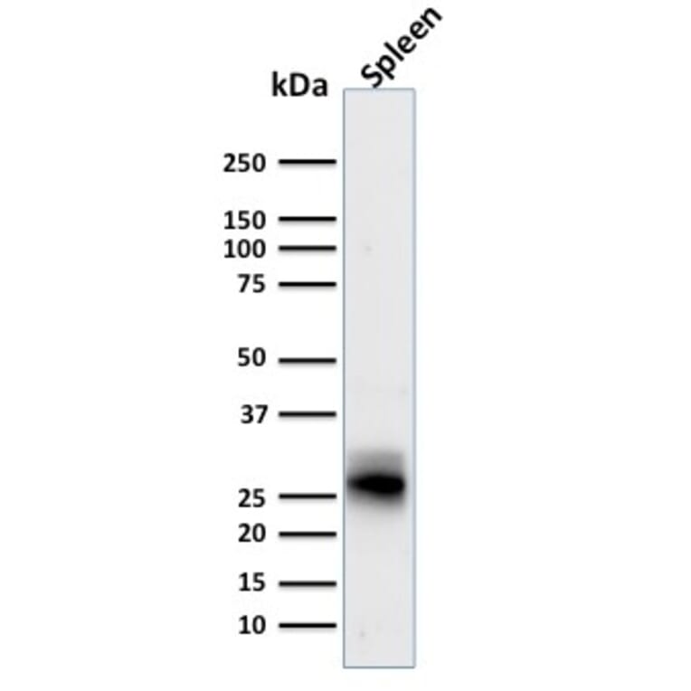 Western Blot - Anti-HLA DRB Antibody [SPM423] - BSA and Azide free (A248854) - Antibodies.com