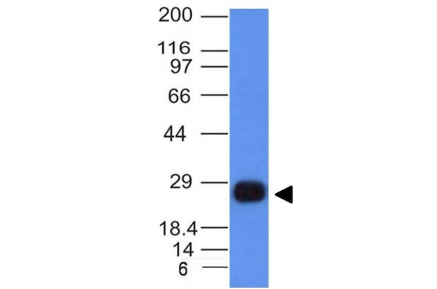 Western Blot - Anti-HLA DRB Antibody [HLA-DRB/1067] - BSA and Azide free (A252035) - Antibodies.com