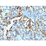Immunohistochemistry - Anti-HLA DRB Antibody [HLA-DRB/1067] - BSA and Azide free (A252035) - Antibodies.com