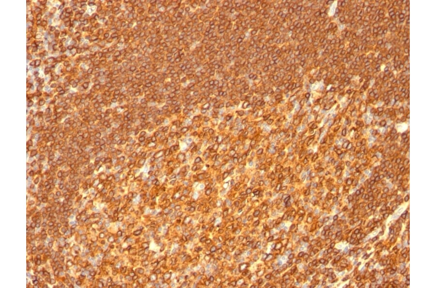 Immunohistochemistry - Anti-HLA DRB Antibody [HLA-DRB/1067] - BSA and Azide free (A252035) - Antibodies.com