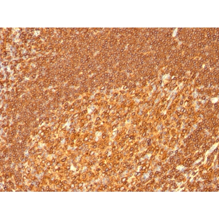 Immunohistochemistry - Anti-HLA DRB Antibody [HLA-DRB/1067] - BSA and Azide free (A252035) - Antibodies.com