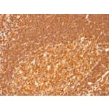 Immunohistochemistry - Anti-HLA DRB Antibody [HLA-DRB/1067] - BSA and Azide free (A252035) - Antibodies.com