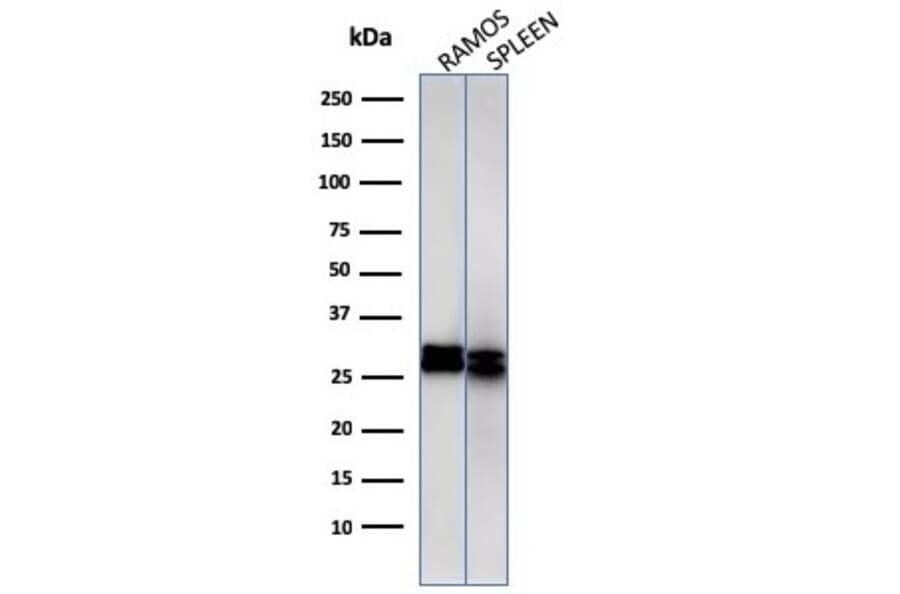 Western Blot - Anti-HLA DRB Antibody [HLA-DRB/1067] - BSA and Azide free (A252035) - Antibodies.com