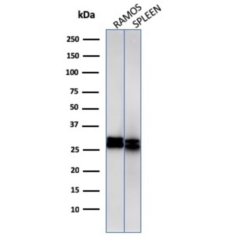 Western Blot - Anti-HLA DRB Antibody [HLA-DRB/1067] - BSA and Azide free (A252035) - Antibodies.com