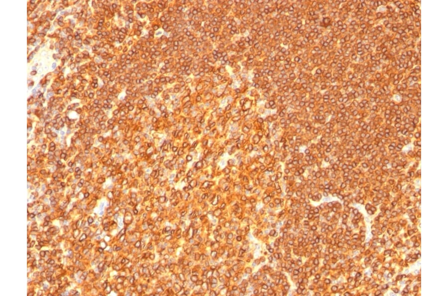 Immunohistochemistry - Anti-HLA DRB Antibody [LN-3 + HLA-DRB/1067] - BSA and Azide free (A248858) - Antibodies.com