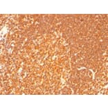 Immunohistochemistry - Anti-HLA DRB Antibody [LN-3 + HLA-DRB/1067] - BSA and Azide free (A248858) - Antibodies.com