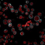 Immunofluorescence - Anti-HLA DRB Antibody [LN-3 + HLA-DRB/1067] - BSA and Azide free (A248858) - Antibodies.com
