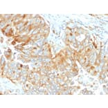 Immunohistochemistry - Anti-HLA DRB Antibody [DA2] - BSA and Azide free (A252038) - Antibodies.com
