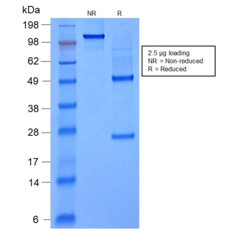 SDS-PAGE - Anti-FOXA1 Antibody [rFOXA1/1515] - BSA and Azide free (A252040) - Antibodies.com