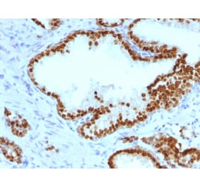 Immunohistochemistry - Anti-FOXA1 Antibody [FOXA1/1241] - BSA and Azide free (A252041) - Antibodies.com