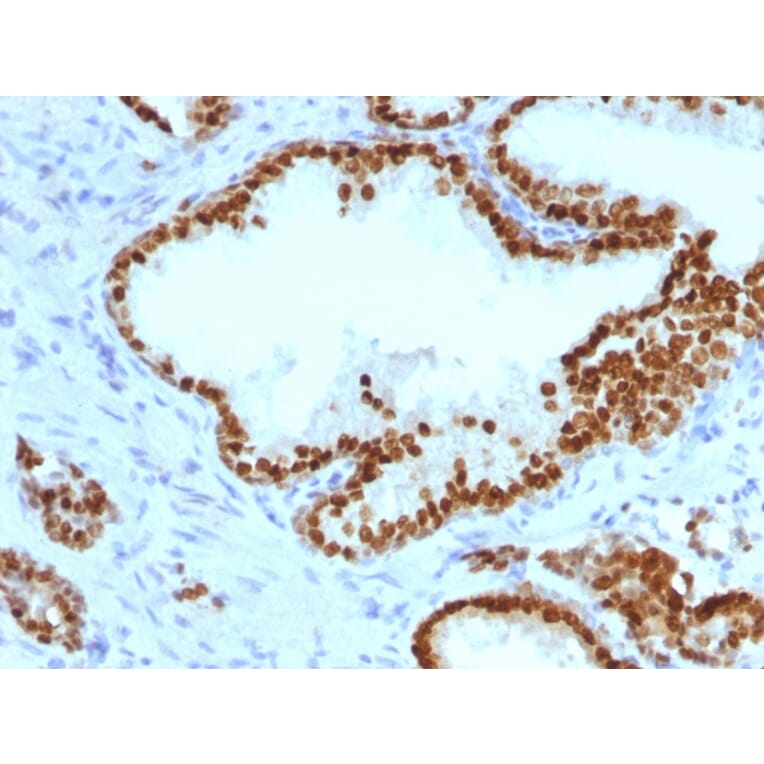 Immunohistochemistry - Anti-FOXA1 Antibody [FOXA1/1241] - BSA and Azide free (A252041) - Antibodies.com