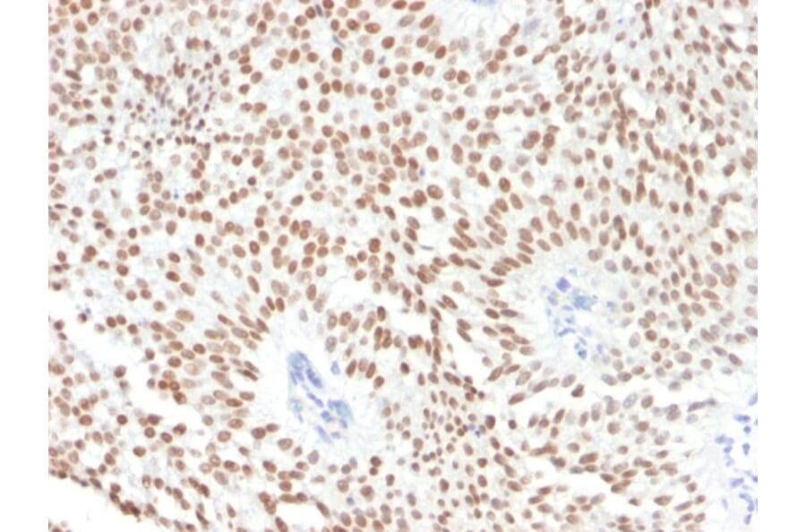 Immunohistochemistry - Anti-FOXA1 Antibody [FOXA1/1241] - BSA and Azide free (A252041) - Antibodies.com