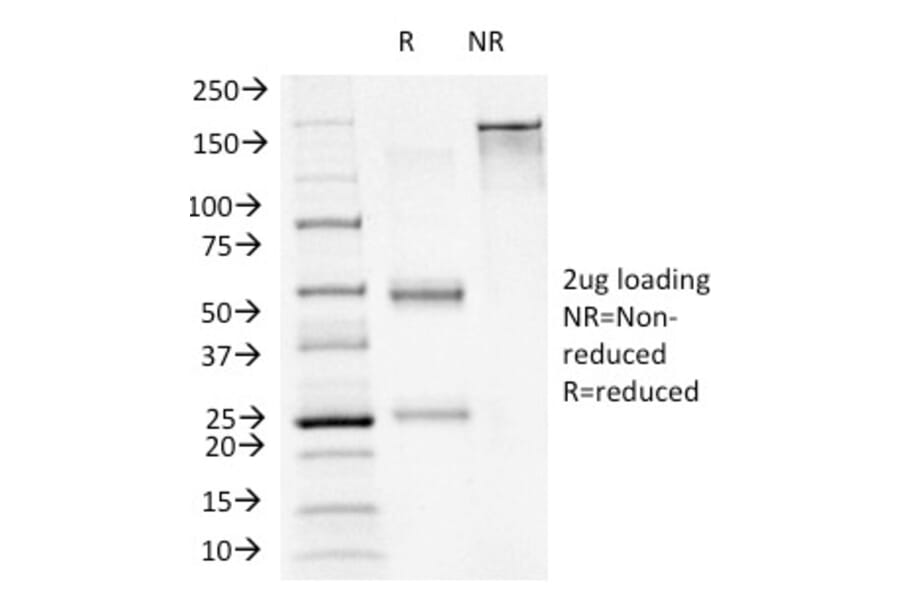 SDS-PAGE - Anti-FOXA1 Antibody [FOXA1/1241] - BSA and Azide free (A252041) - Antibodies.com