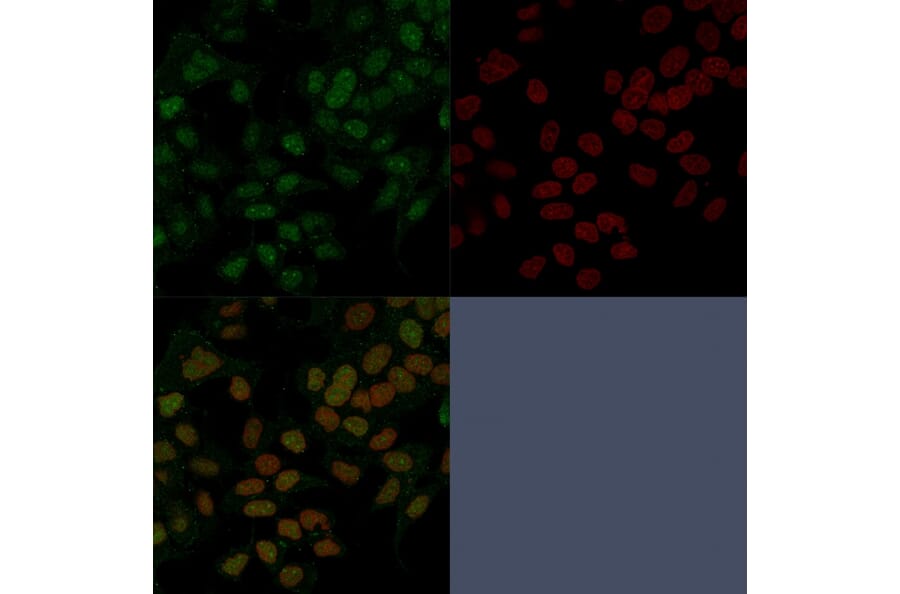 Immunofluorescence - Anti-FOXA1 Antibody [FOXA1/1241] - BSA and Azide free (A252041) - Antibodies.com