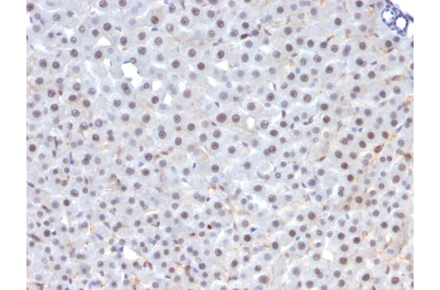 Immunohistochemistry - Anti-FOXA1 Antibody [FOXA1/1241] - BSA and Azide free (A252041) - Antibodies.com