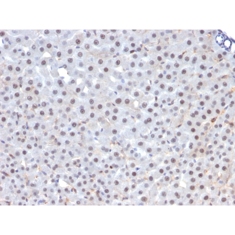 Immunohistochemistry - Anti-FOXA1 Antibody [FOXA1/1241] - BSA and Azide free (A252041) - Antibodies.com