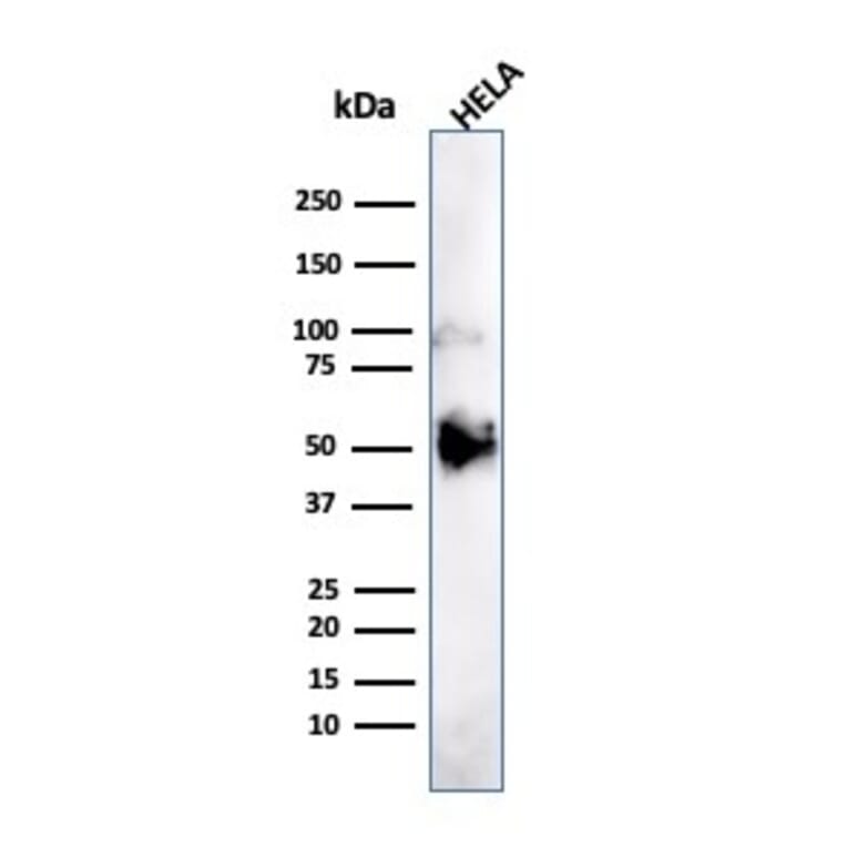Western Blot - Anti-FOXA1 Antibody [FOXA1/1241] - BSA and Azide free (A252041) - Antibodies.com