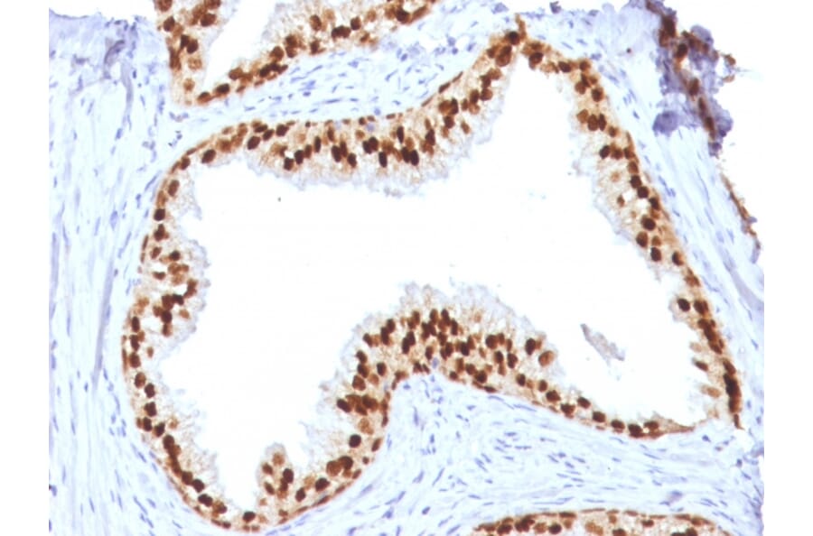 Immunohistochemistry - Anti-FOXA1 Antibody [FOXA1/1512] - BSA and Azide free (A252042) - Antibodies.com