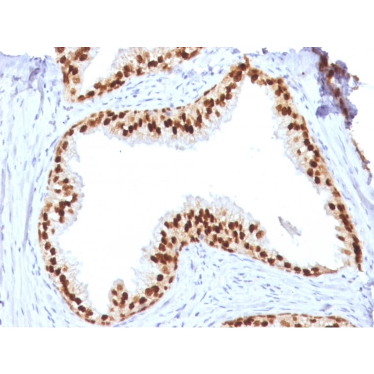 Immunohistochemistry - Anti-FOXA1 Antibody [FOXA1/1512] - BSA and Azide free (A252042) - Antibodies.com
