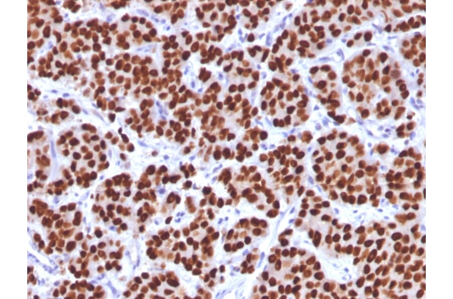 Immunohistochemistry - Anti-FOXA1 Antibody [FOXA1/1512] - BSA and Azide free (A252042) - Antibodies.com