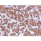 Immunohistochemistry - Anti-FOXA1 Antibody [FOXA1/1512] - BSA and Azide free (A252042) - Antibodies.com