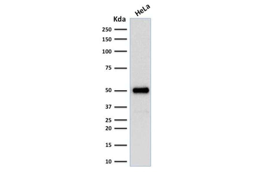 Western Blot - Anti-FOXA1 Antibody [FOXA1/1512] - BSA and Azide free (A252042) - Antibodies.com