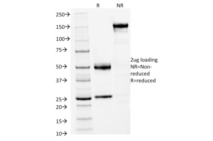 SDS-PAGE - Anti-FOXA1 Antibody [FOXA1/1512] - BSA and Azide free (A252042) - Antibodies.com