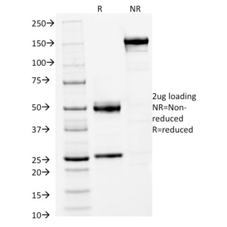 SDS-PAGE - Anti-FOXA1 Antibody [FOXA1/1512] - BSA and Azide free (A252042) - Antibodies.com