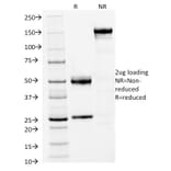 SDS-PAGE - Anti-FOXA1 Antibody [FOXA1/1512] - BSA and Azide free (A252042) - Antibodies.com