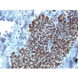 Immunohistochemistry - Anti-FOXA1 Antibody [FOXA1/1514] - BSA and Azide free (A252042) - Antibodies.com
