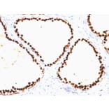Immunohistochemistry - Anti-FOXA1 Antibody [FOXA1/1515] - BSA and Azide free (A252044) - Antibodies.com