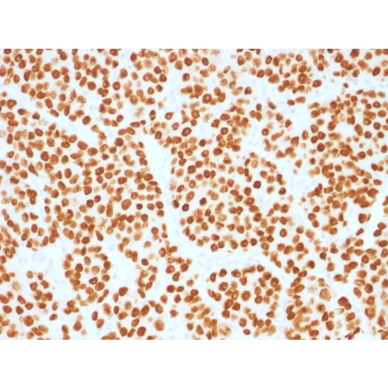 Immunohistochemistry - Anti-FOXA1 Antibody [FOXA1/1515] - BSA and Azide free (A252044) - Antibodies.com